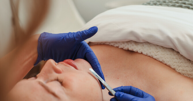 Dermaplaning Experience